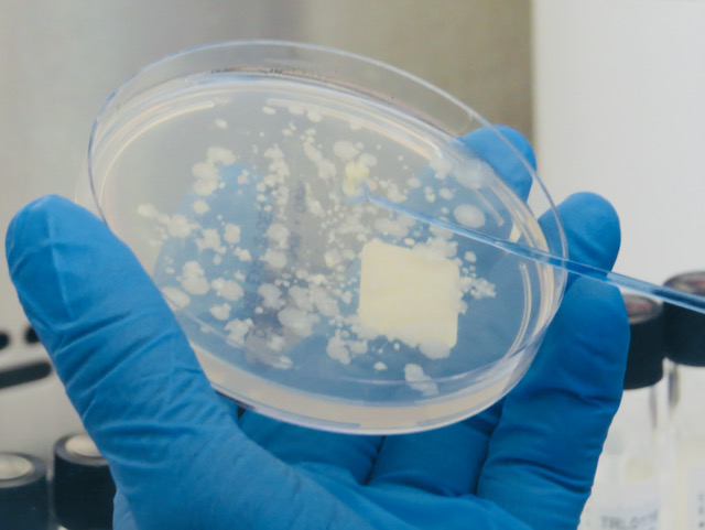 Press release – Largest ever global study of tuberculosis identifies genetic causes of drug resistance
